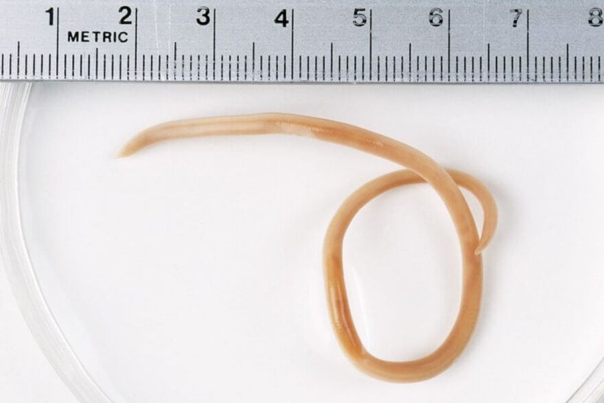 Roundworm is a roundworm that lives in the human body